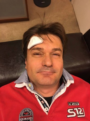 Недавно приобрел себе Thync http://www.thync.com/ - новый гаджет, который, по мнению разработчиков, способен улучшать настроение. Девайс работает в двух режимах: c помощью одного я расслабляюсь, с помощью другого - избавляюсь от стресса. В общем, надеюсь обрести дополнительные спокойствие и энергию. https://vc.ru/p/thync